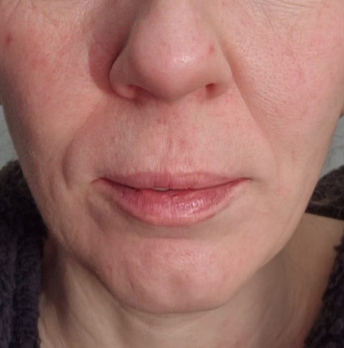Customer photo review of Vegan Collagen - Vollagen®