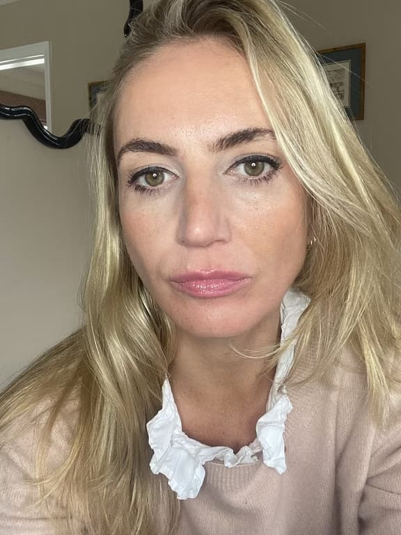 Customer photo review of HoneyNoir - Pink Honey Lipstick