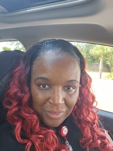 Customer photo review of VIRAL "EXTREME STRENGTH" Hair Growth Serum -