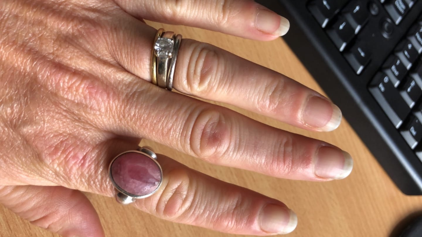 Customer photo review of Vegan Collagen - Vollagen®