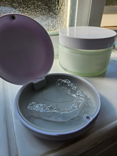 Customer photo review of Upper Essix Retainer