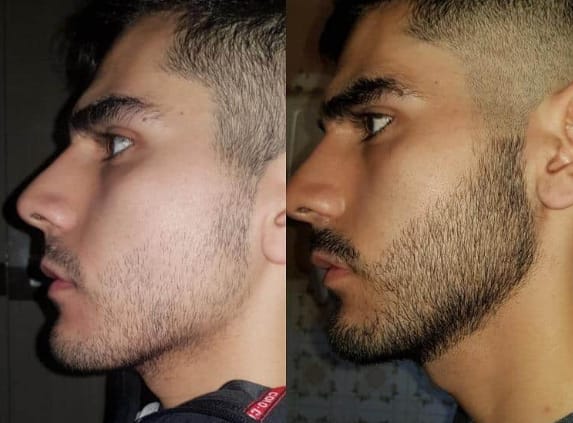 Customer photo review of Lanbena Hair Growth Serum
