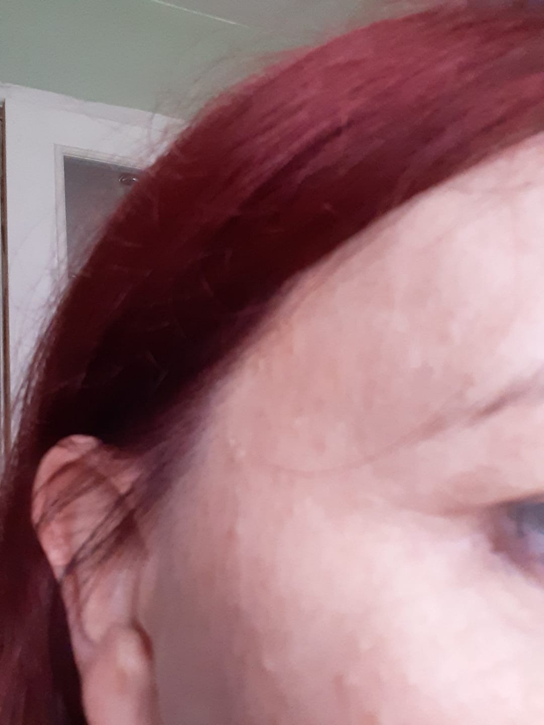 Customer photo review of Vegan Collagen - Vollagen®