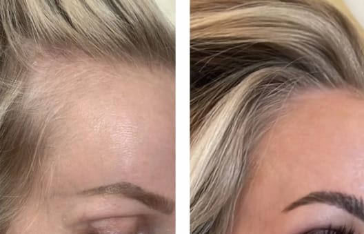 Customer photo review of Lanbena Hair Growth Serum