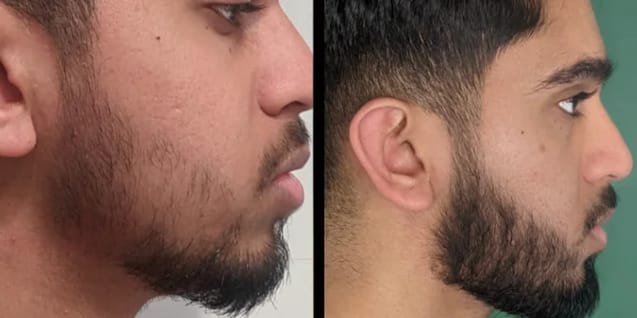 Customer photo review of Lanbena Hair Growth Serum