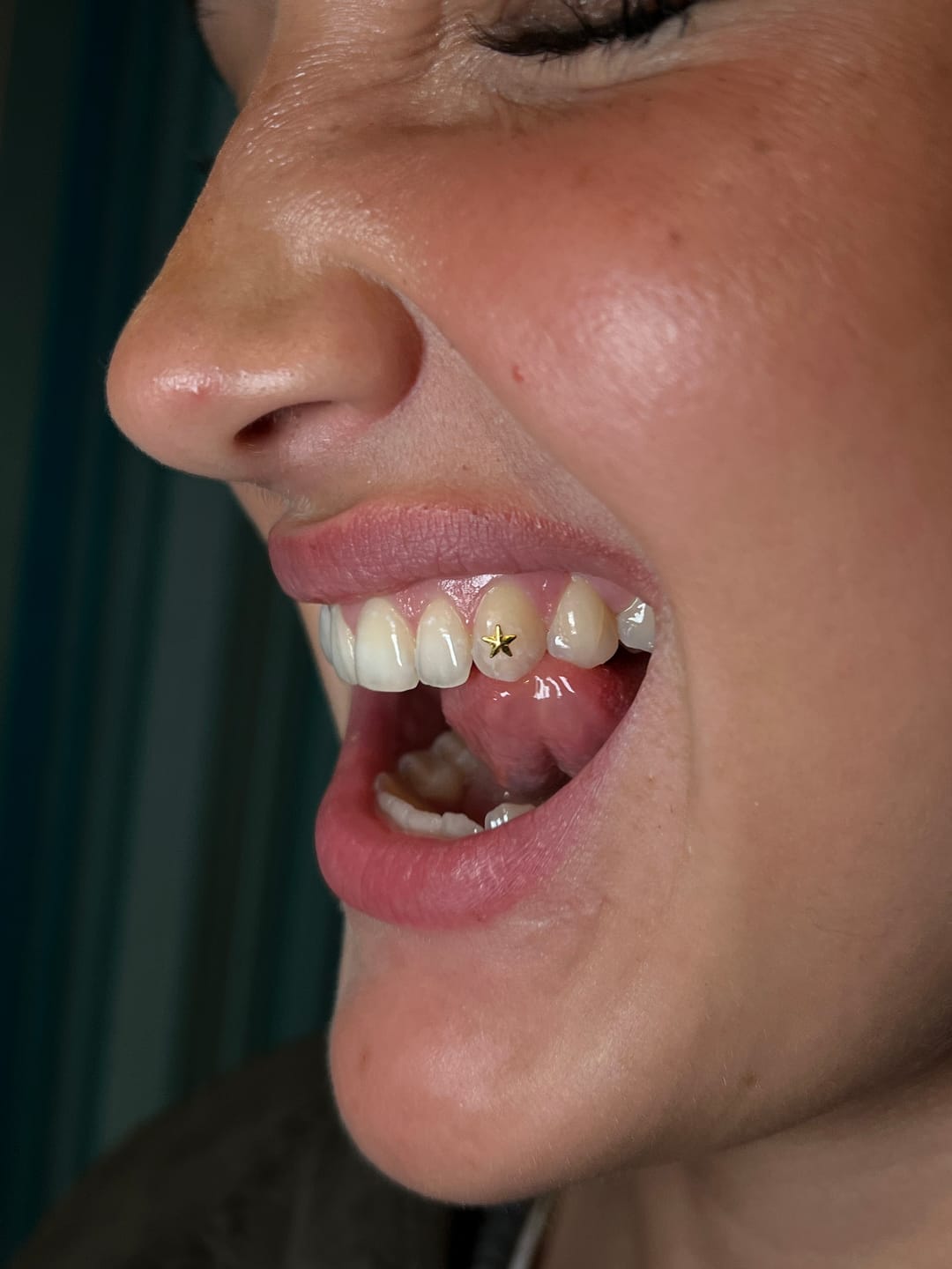 Customer photo review of Small Star 24-karat gold