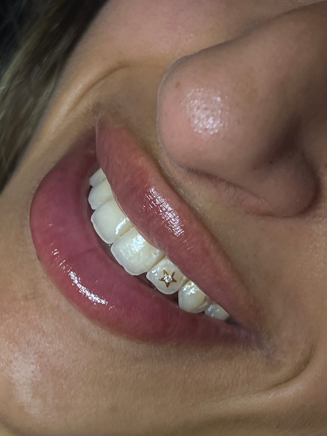 Customer photo review of Star w. Diamond 22-karat gold