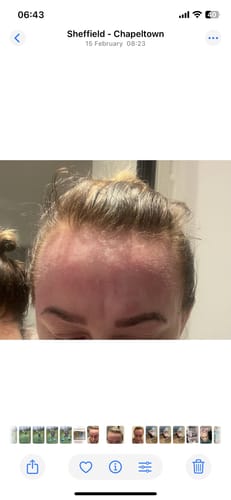 Customer photo review of #No1 Natural Calming Serum