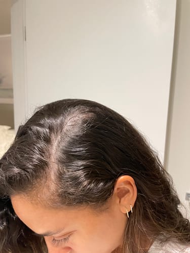 Customer photo review of VITAFOAM ™ Hair Growth Formula