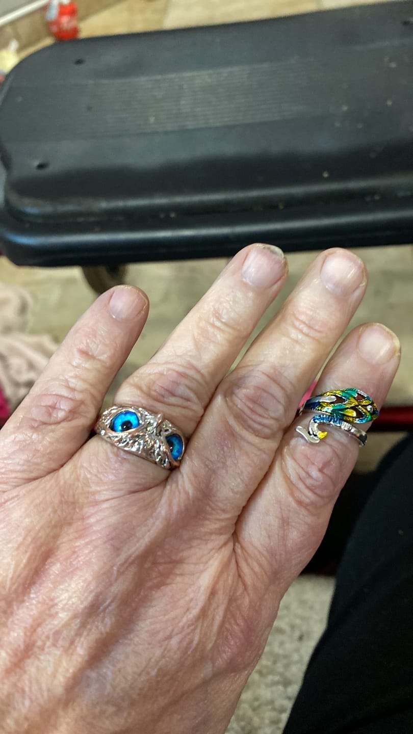 Customer photo review of Shipping Protection