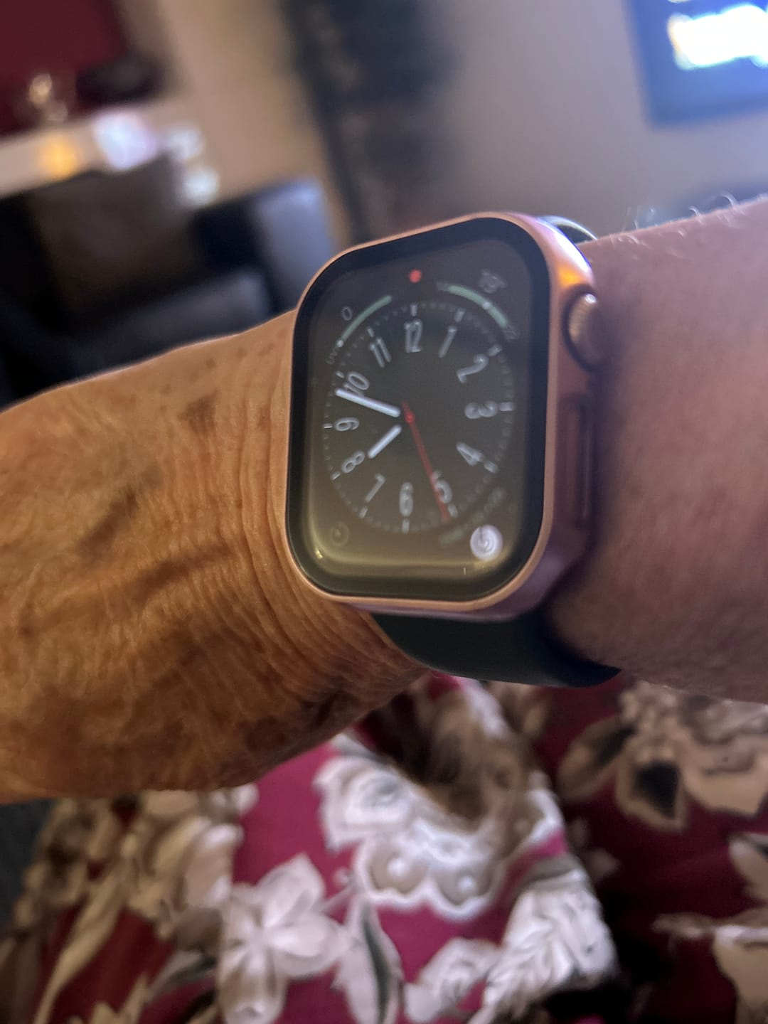Customer photo review of All-in-one classic Apple Watch Protection Case