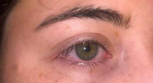 Customer photo review of Lash Growth Serum