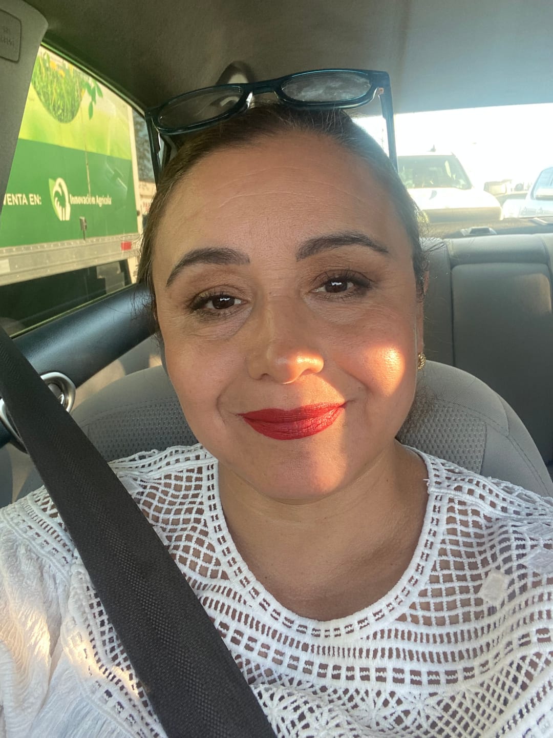 Customer photo review of Kit Los 4 Fantásticos (44% OFF) - Serum de Vitamina C 30ml + Serum de Niacinamida 30ml + Serum Ácido Glicólico 30ml + Serum de Ácido Hialurónico 30ml