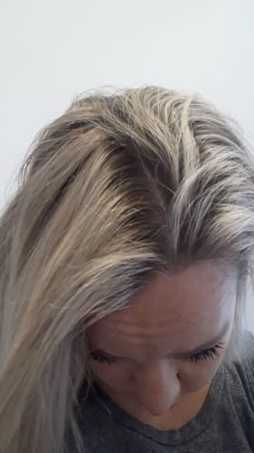 Customer photo review of Hair Growth + Strength