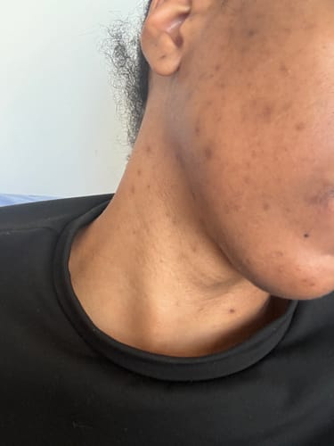 Customer photo review of Turmeric Glow Soap