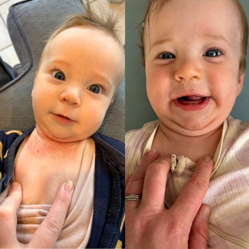 Customer photo review of Calm Balm