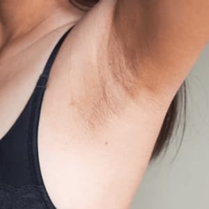 Customer photo review of Organic Lymphatic Support Herbal Extract