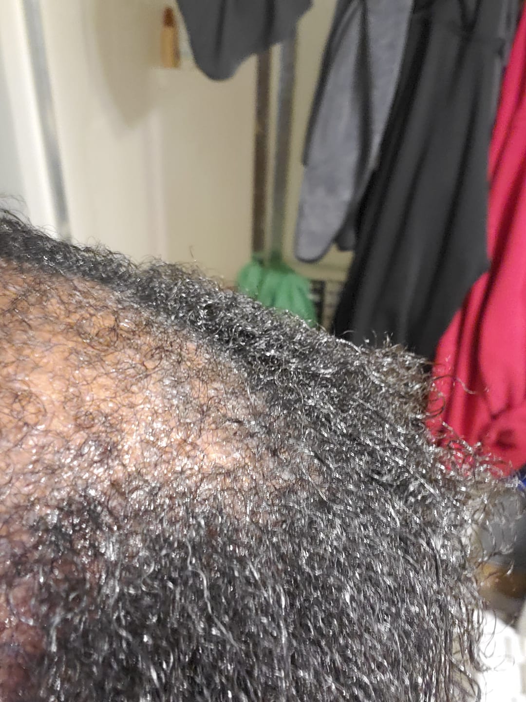 Customer photo review of COMPLETE HAIR RESTORATION & GROWTH SYSTEM