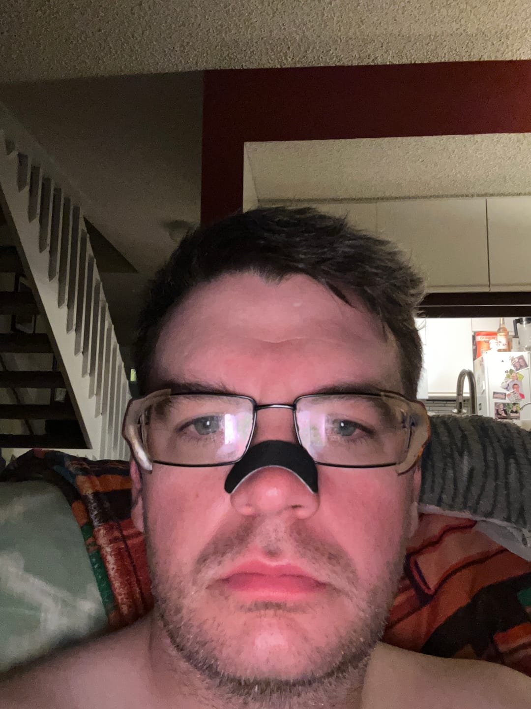 Customer photo review of Hostage Nose Strips