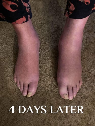 Customer photo review of Organic Lymphatic Support Herbal Extract