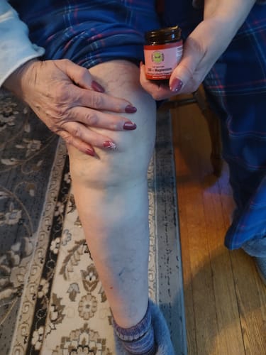 Customer photo review of CBD + Magnesium No More Aches Full Spectrum Caliente Topical Cream