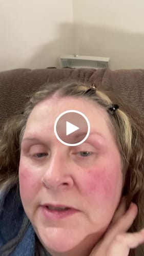 Customer video review of Glov Micro Infusion System