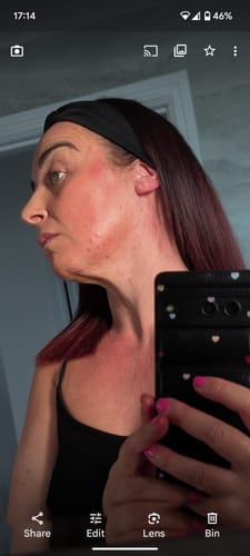 Customer photo review of MYLASMOSS SEAMOSS GEL (340ML)