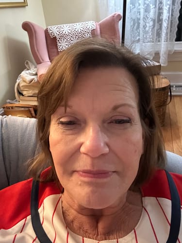 Customer photo review of Glov Micro Infusion System