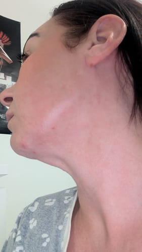 Customer photo review of MYLASMOSS SEAMOSS GEL (340ML)