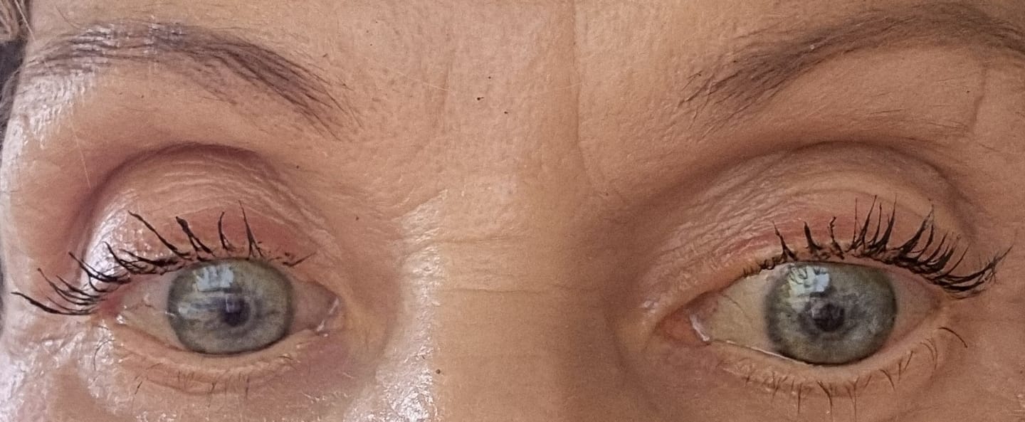 Customer photo review of Purely Lashes Lash Growth Serum