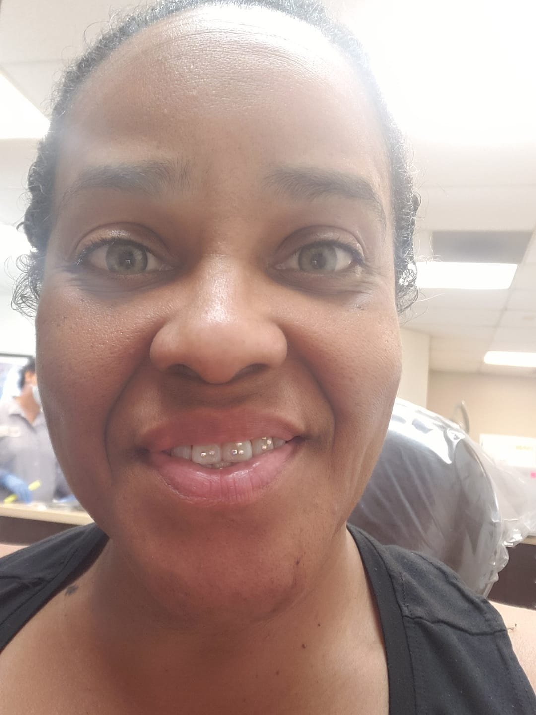 Customer photo review of Himalaya Brown Prescription  Colored Contact Lenses