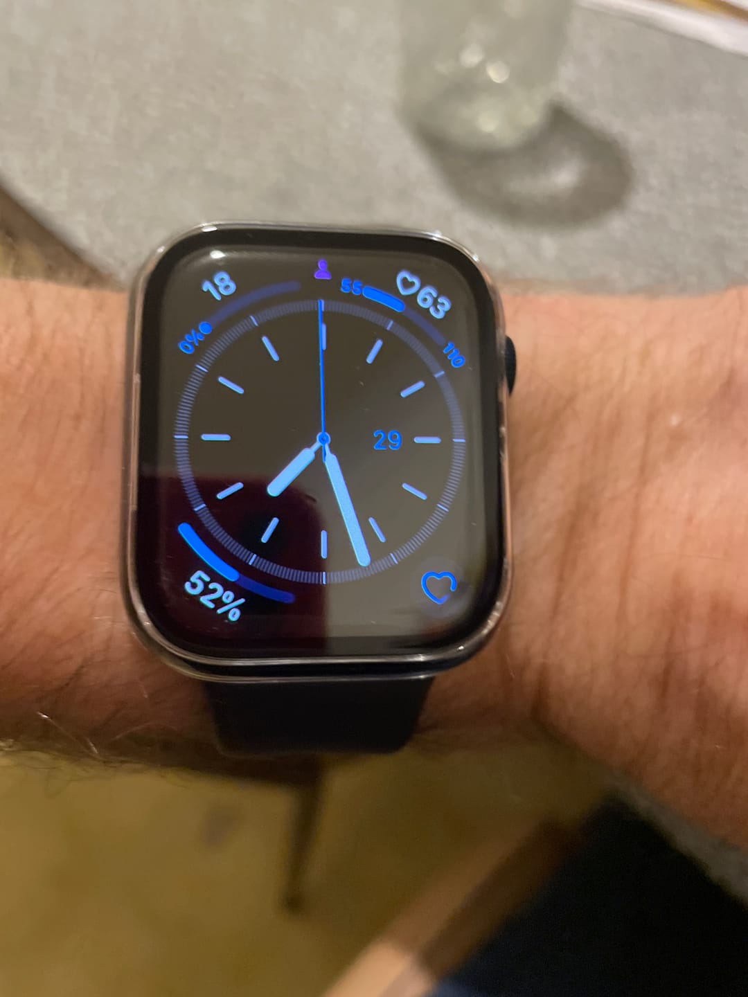 Customer photo review of All-in-one classic Apple Watch Protection Case