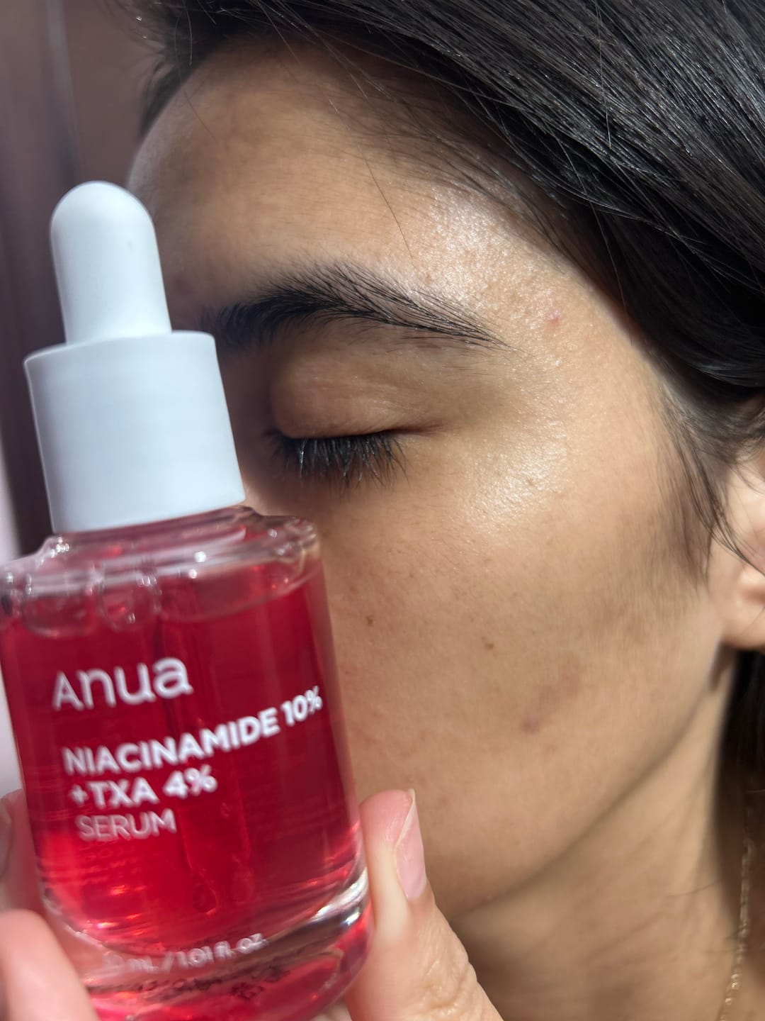 Customer photo review of ANUA - Niacinamide 10% + TXA 4% Serum 30 ML | Suero Antimanchas
