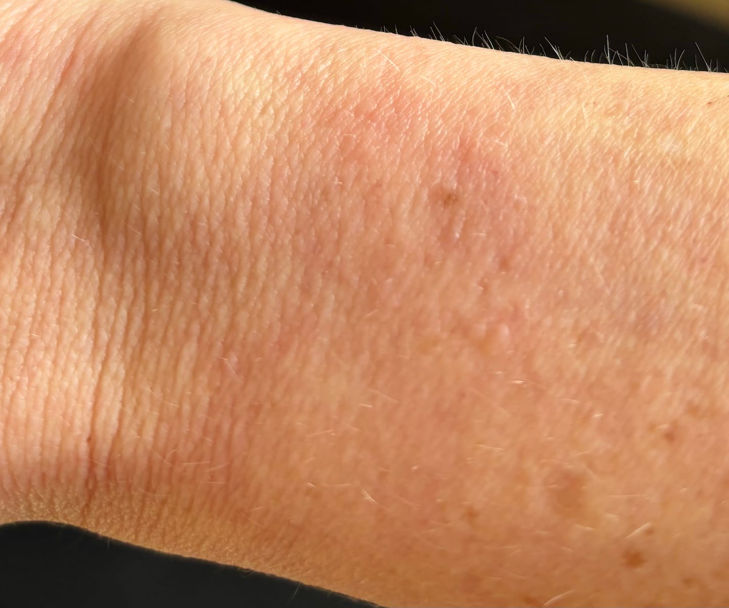 Customer photo review of Bioskin Zeoderm Skin Repair Moisturiser