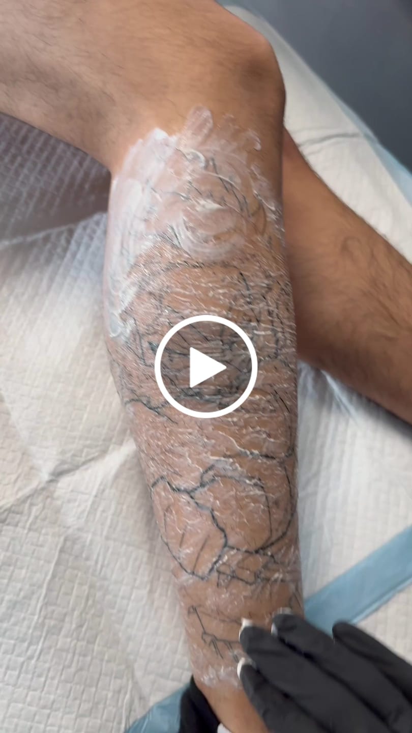 Customer video review of 1.69 oz 50ML Numbing Cream Natural Effective