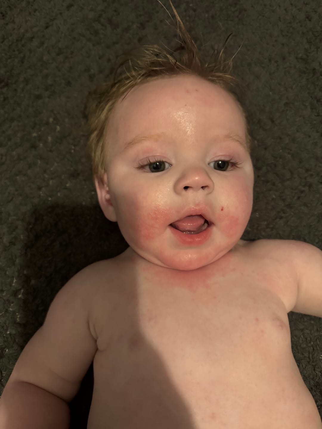 Customer photo review of Bioskin Junior Duo Pack