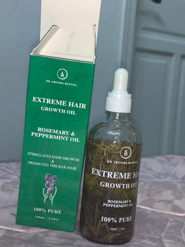 Customer photo review of Medicated Hair Loss Advanced Solution - PERMANENT TREATMENT FOR HAIRLOSS!