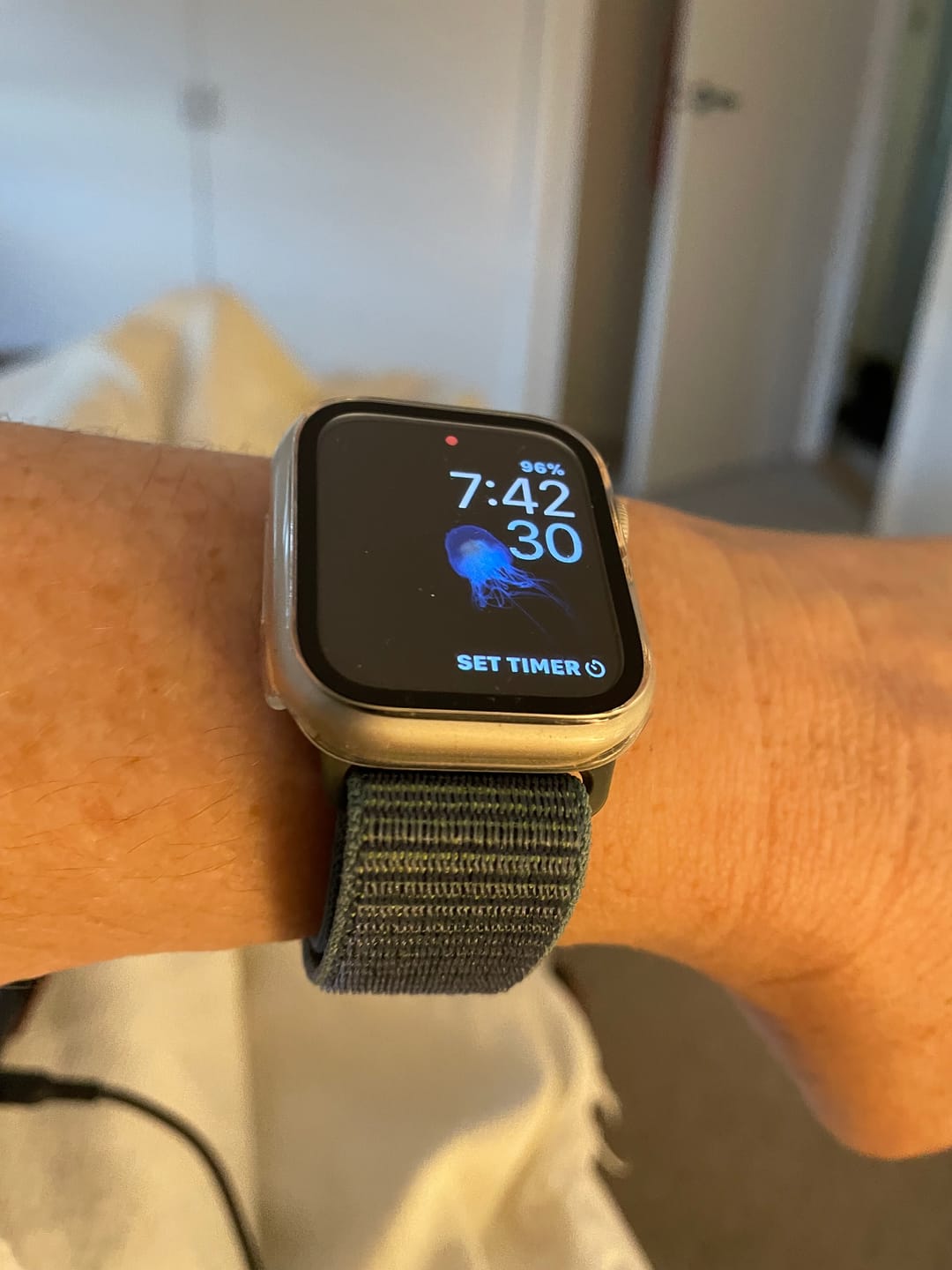 Customer photo review of All-in-one classic Apple Watch Protection Case
