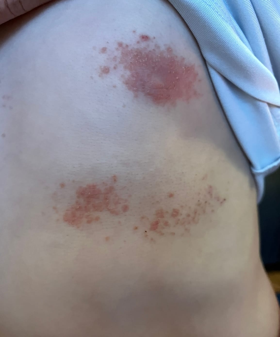 Customer photo review of Bioskin Junior Duo Pack