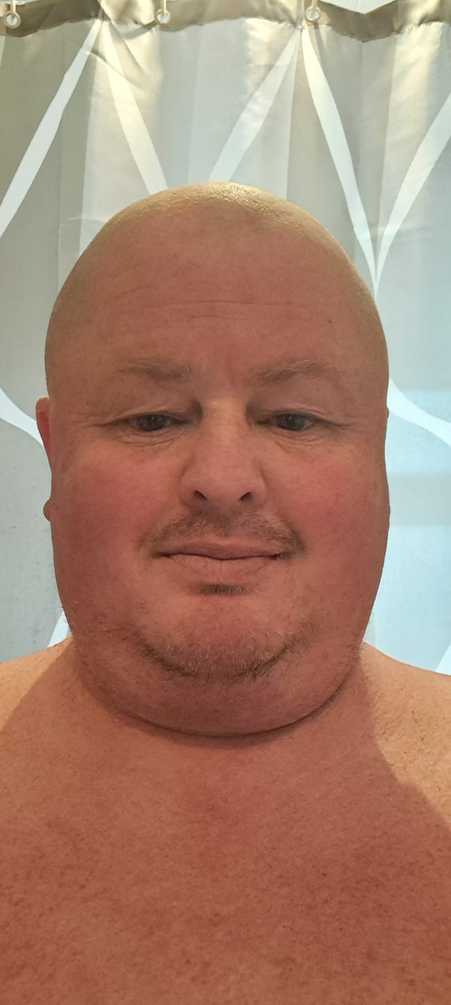 Customer photo review of Trimpod 3.0: The Ultimate Shaver for Bald Men