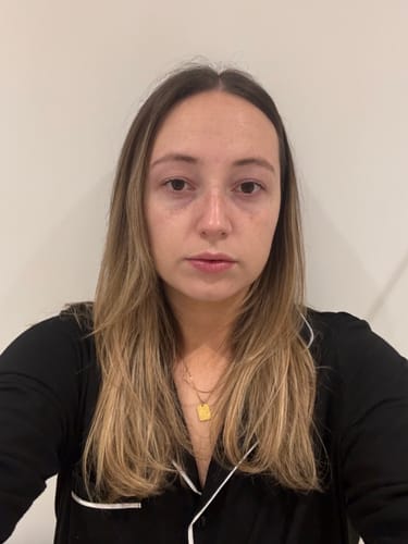 Customer photo review of Sunbright - Tinted Tan Drops 30ml