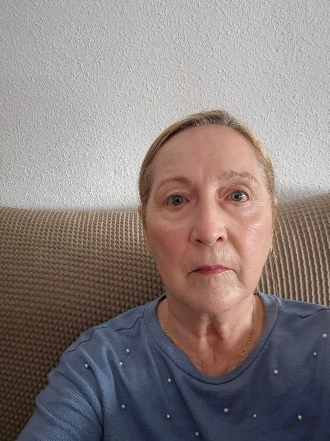 Customer photo review of Solución Exfoliante Química renovadora MAKTUB
