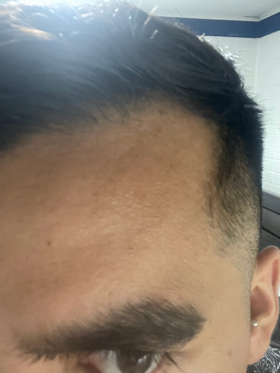 Customer photo review of DUO ANTIcaída CRECIMIENTO INTENSIVO Bomba + Tónico