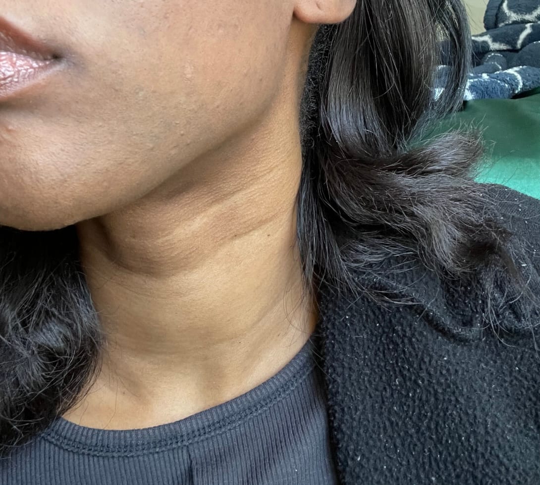 Customer photo review of White Secret Body Soap 190 G