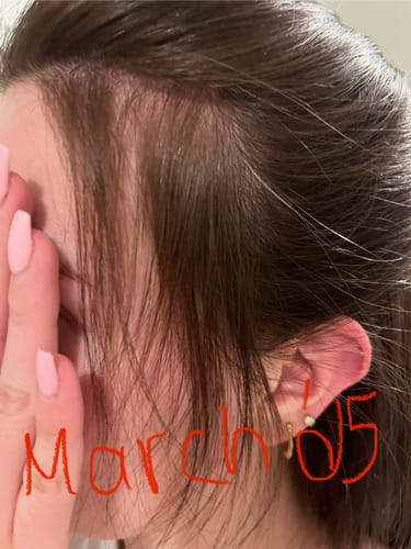 Customer photo review of Pre-Wash Scalp Oil by TR