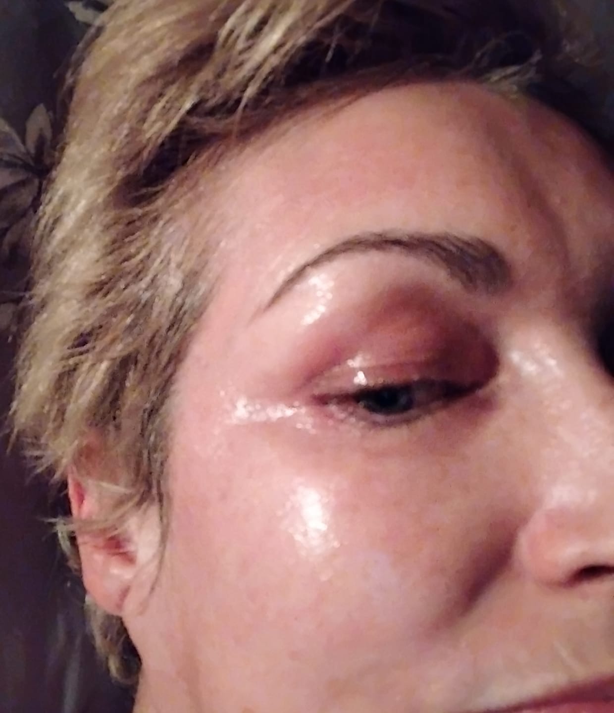 Customer photo review of Système de micro perfusion Glov Beauté