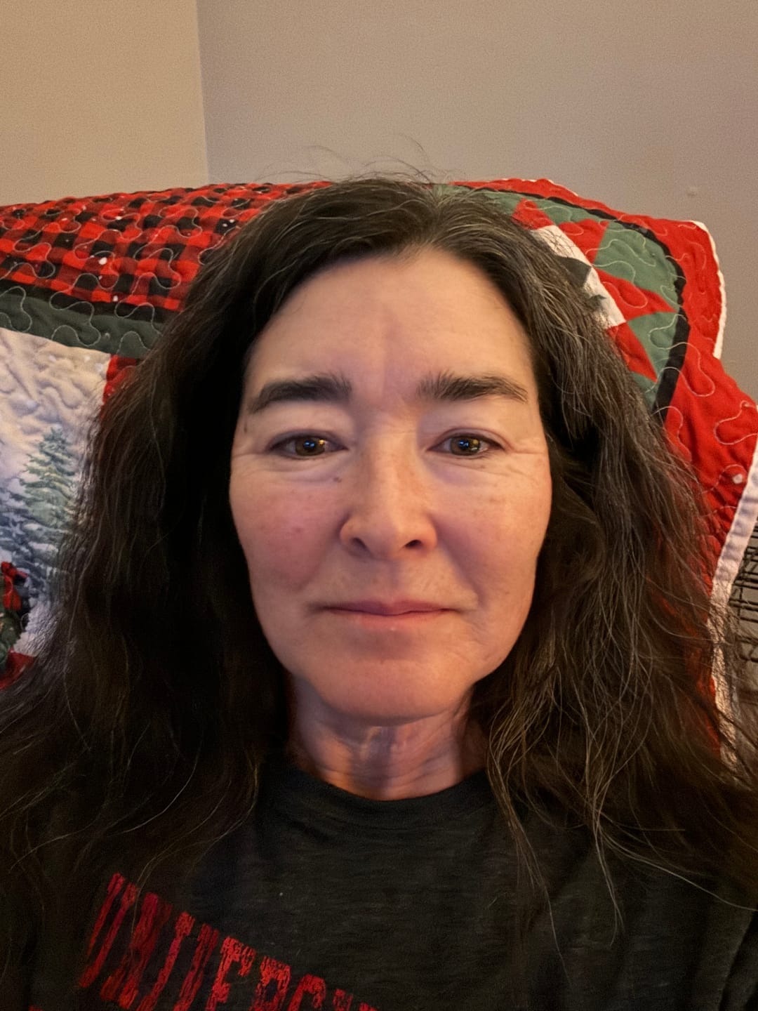Customer photo review of Système de micro perfusion Glov Beauté