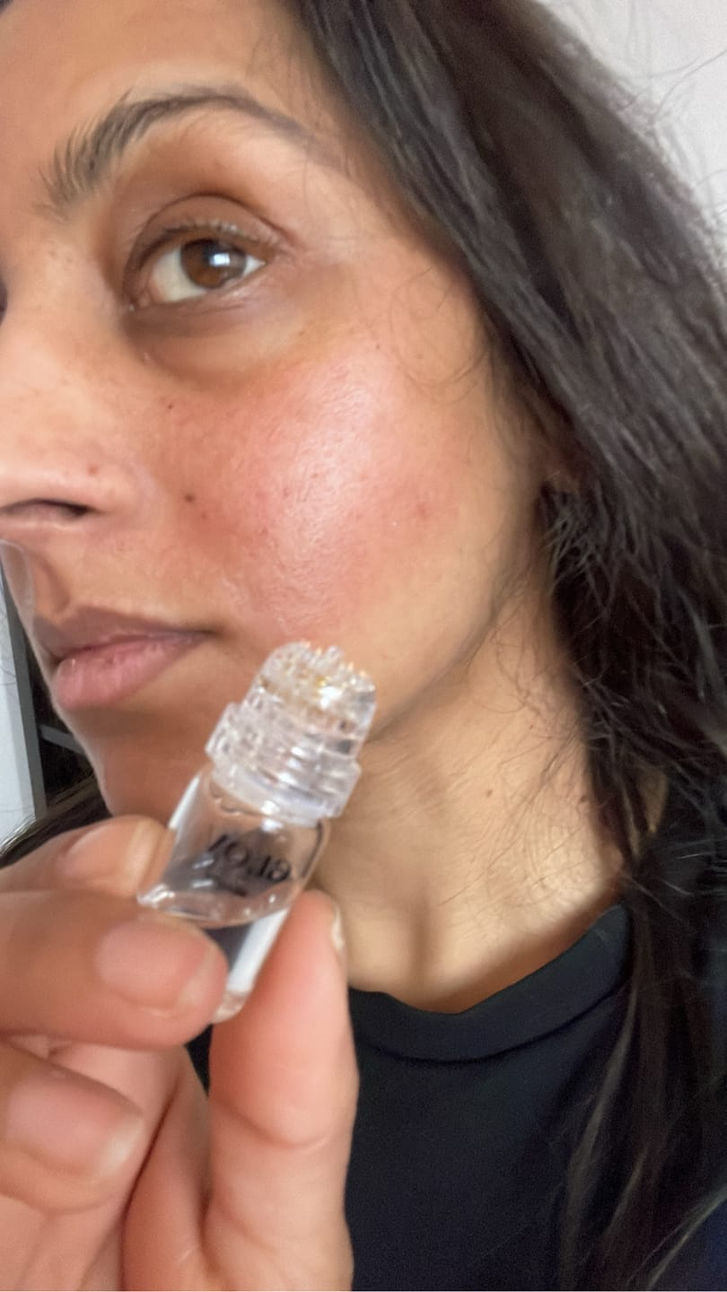 Customer photo review of Système de micro perfusion Glov Beauté