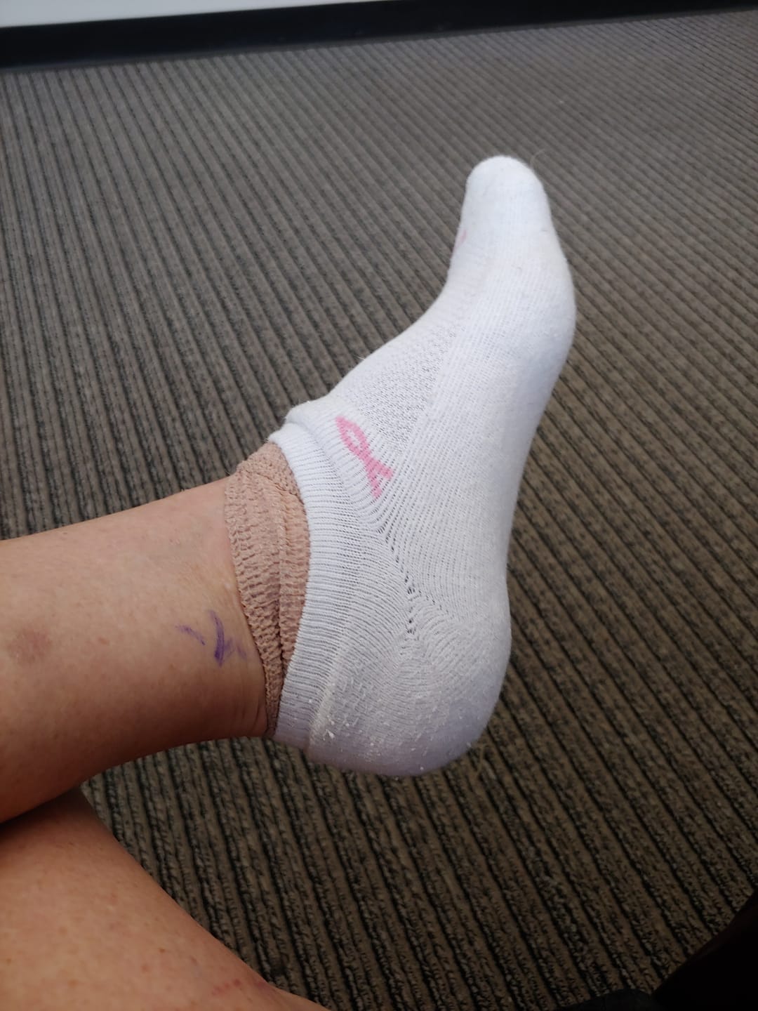 Customer photo review of 2 Pr Women's Low Cut Tab Ankle Socks