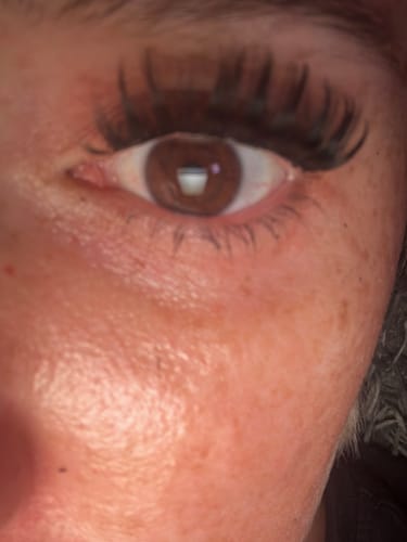 Customer photo review of NO FILTER STARTER KIT (12mm-14mm)